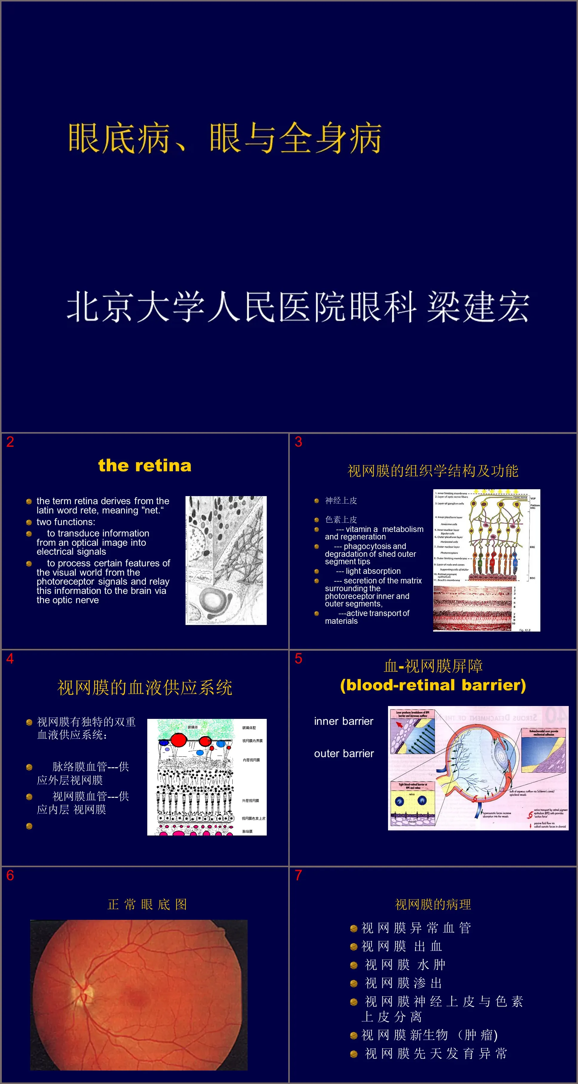 149眼底病、眼与全身病备份