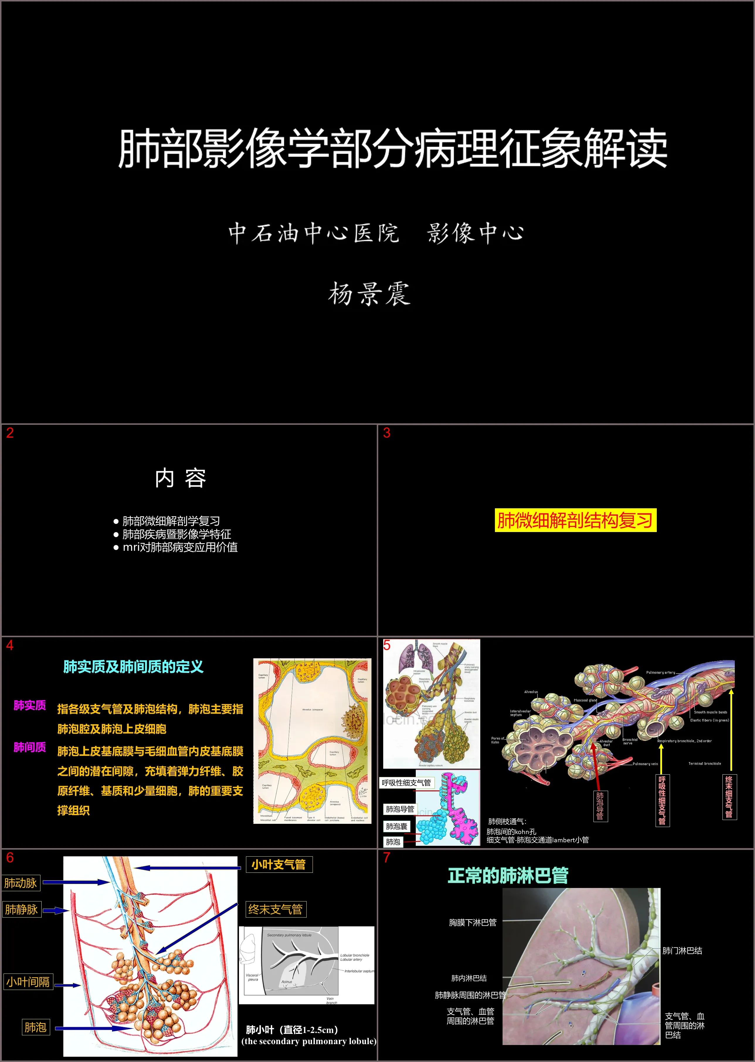 肺部影像学部分病理征象解读