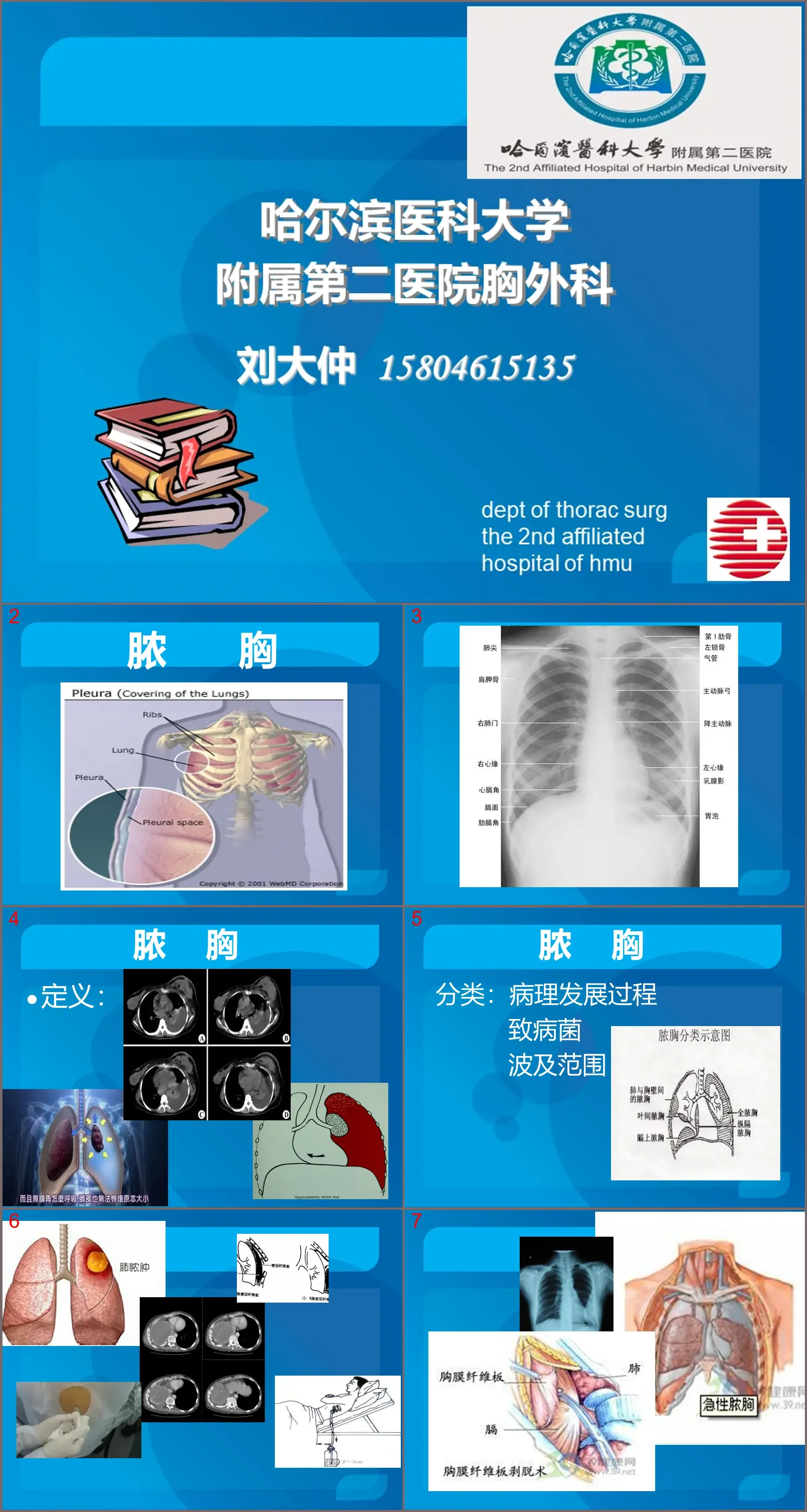 03传染科-脓胸