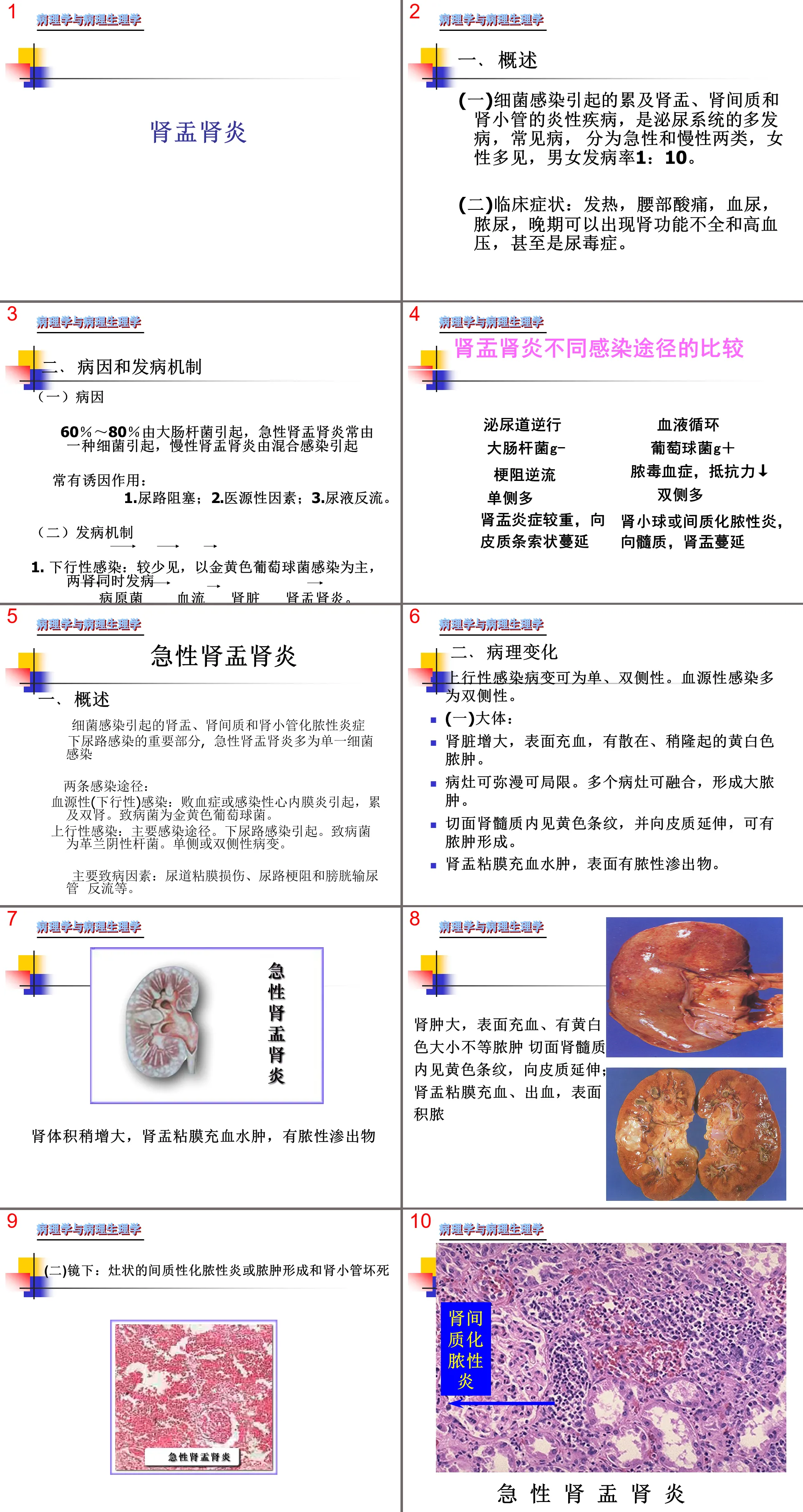 105肾内科-肾盂肾炎1