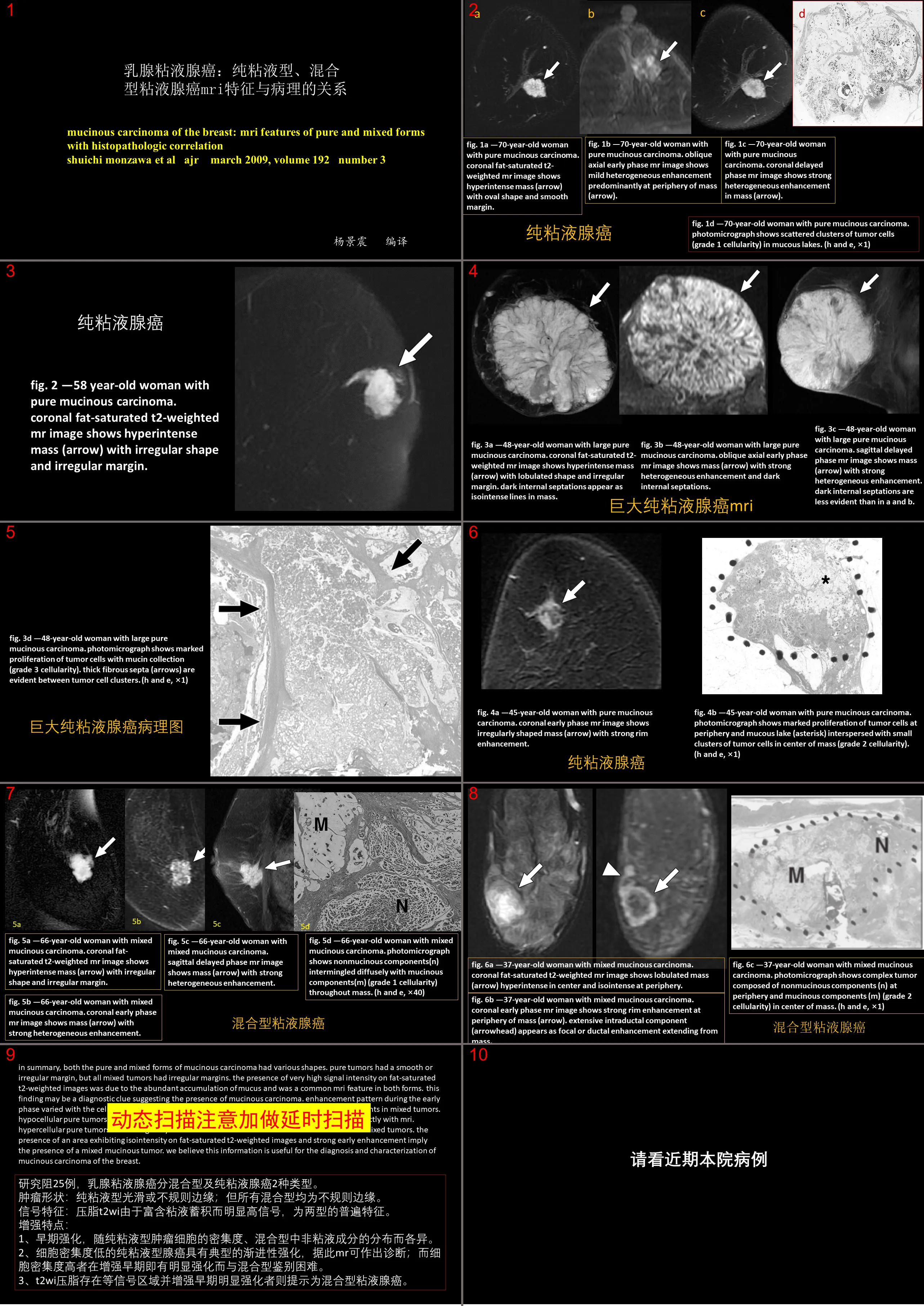 MRI and pathological features of breast mucinous adenocarcinoma