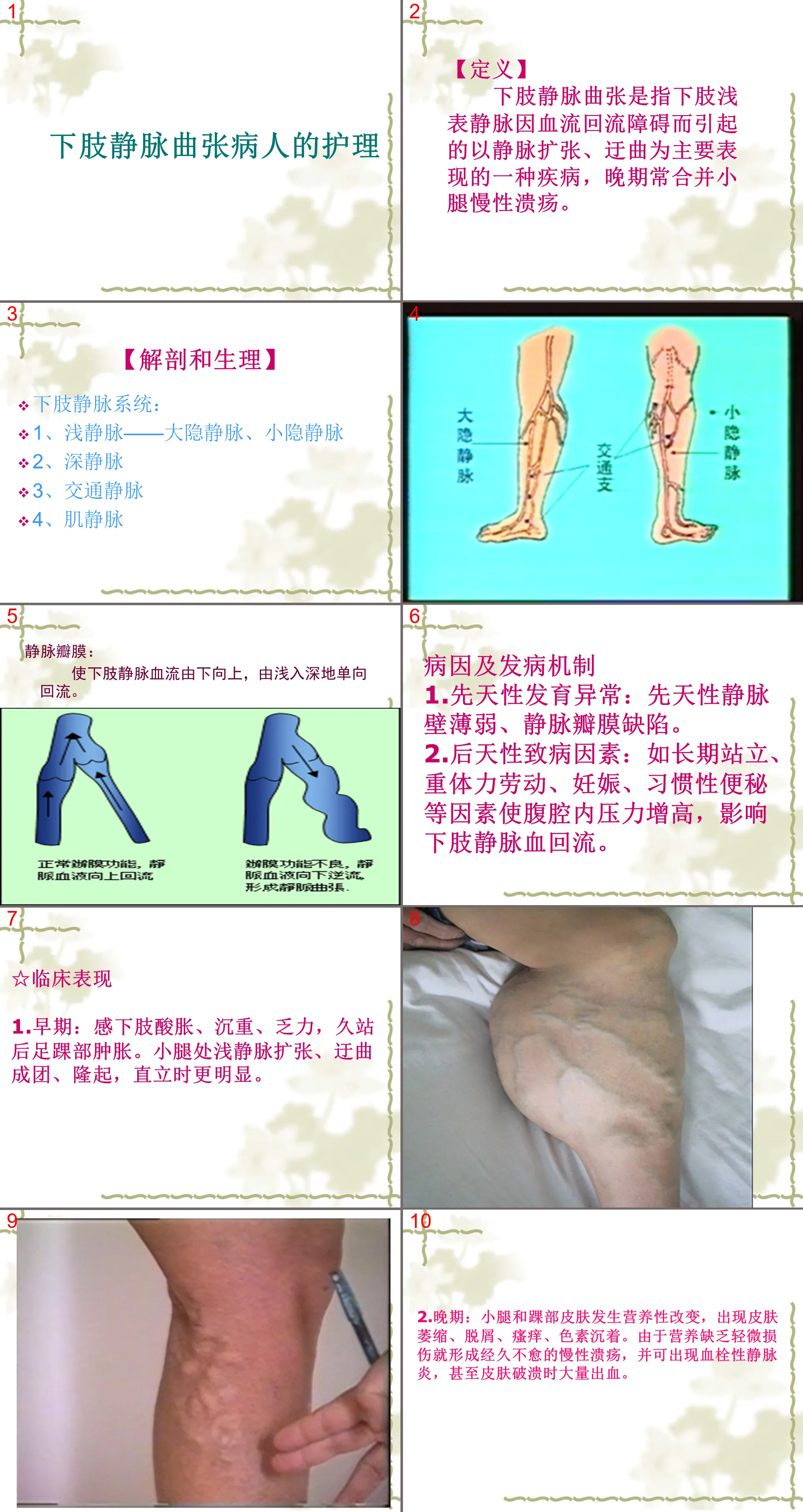 127 Nursing Care for Patients with Varicose Veins of Lower Limbs