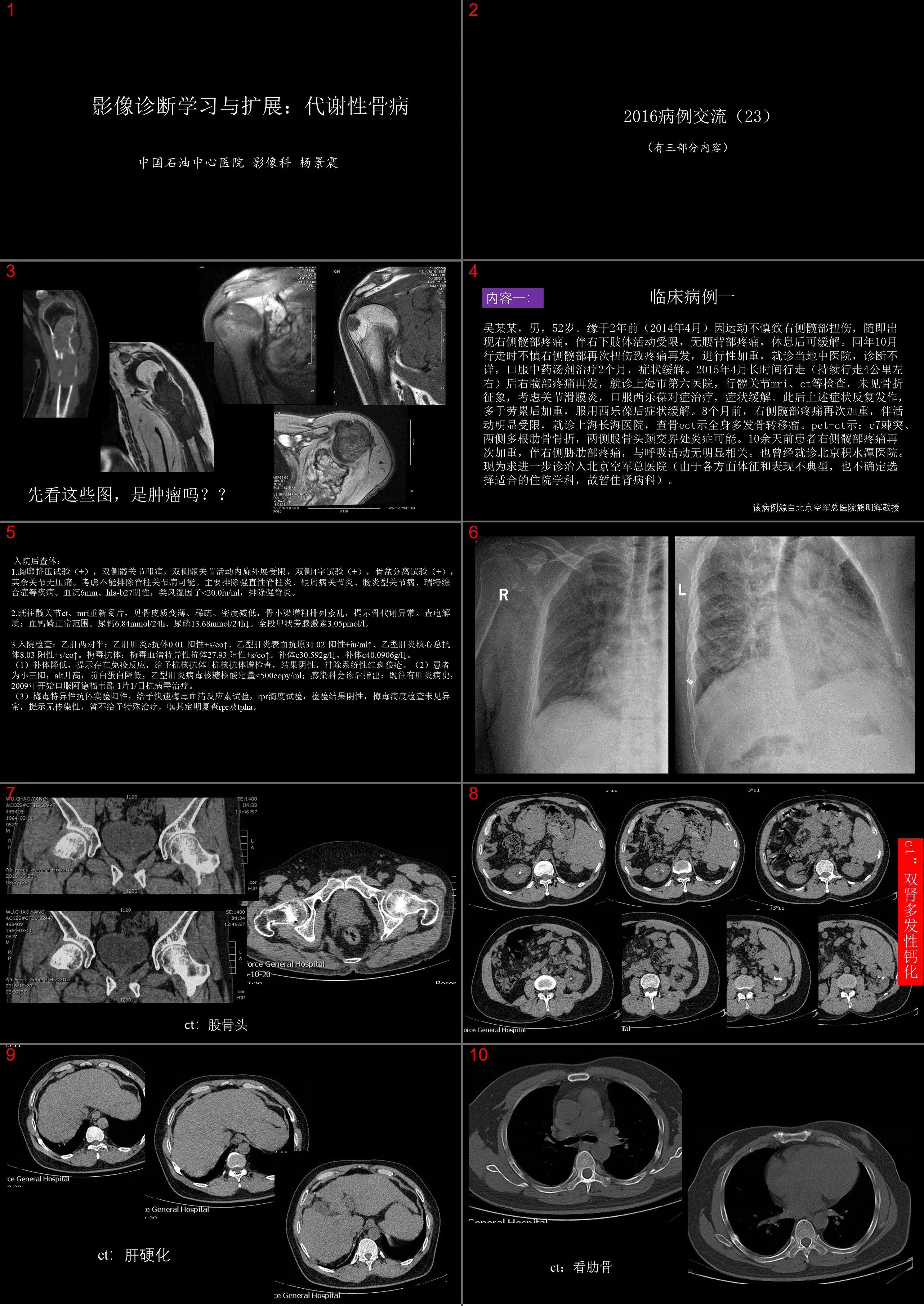 Imaging diagnosis learning and extension: metabolic bone disease (Case 23)