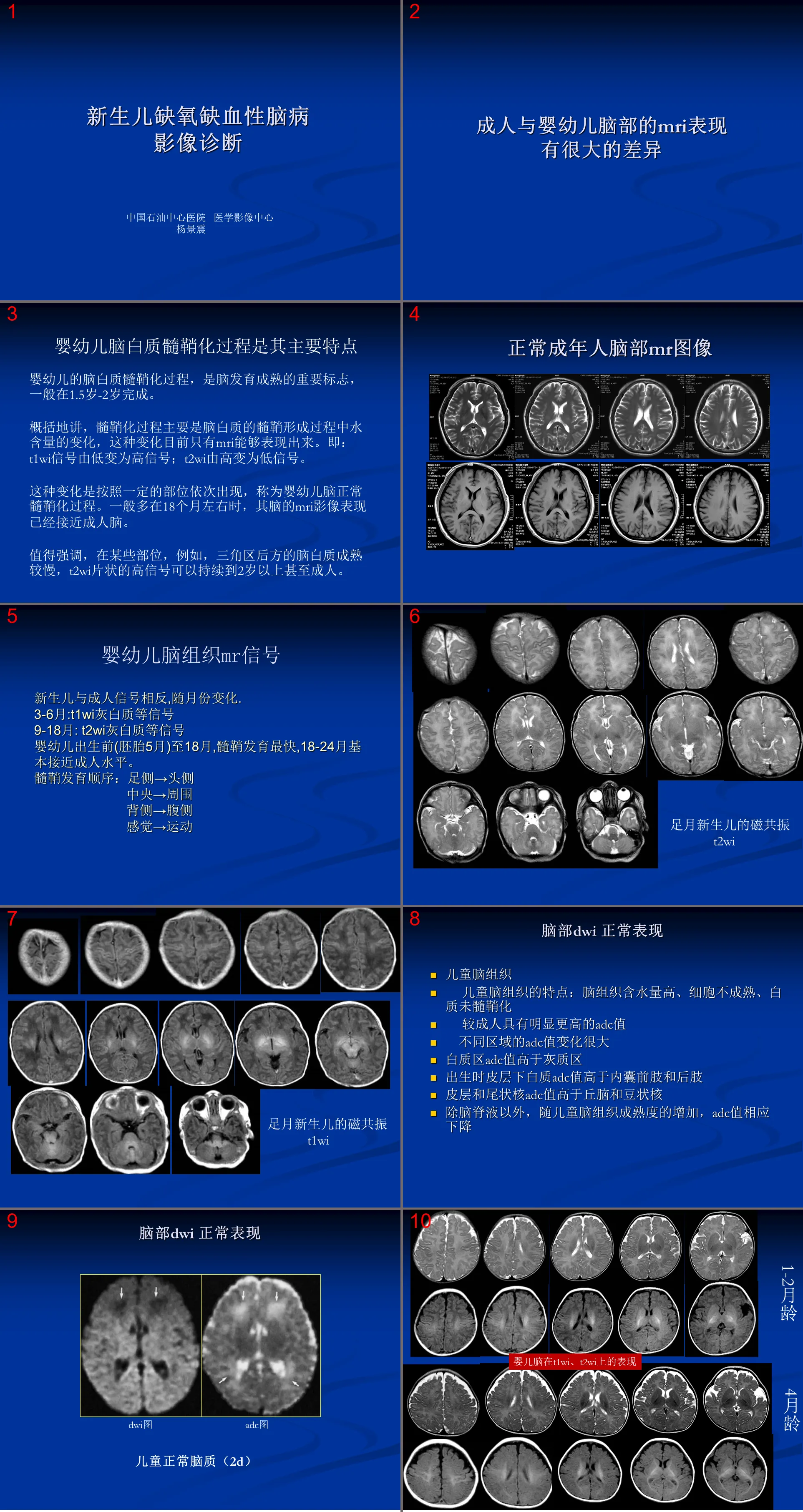 新生儿缺氧缺血性