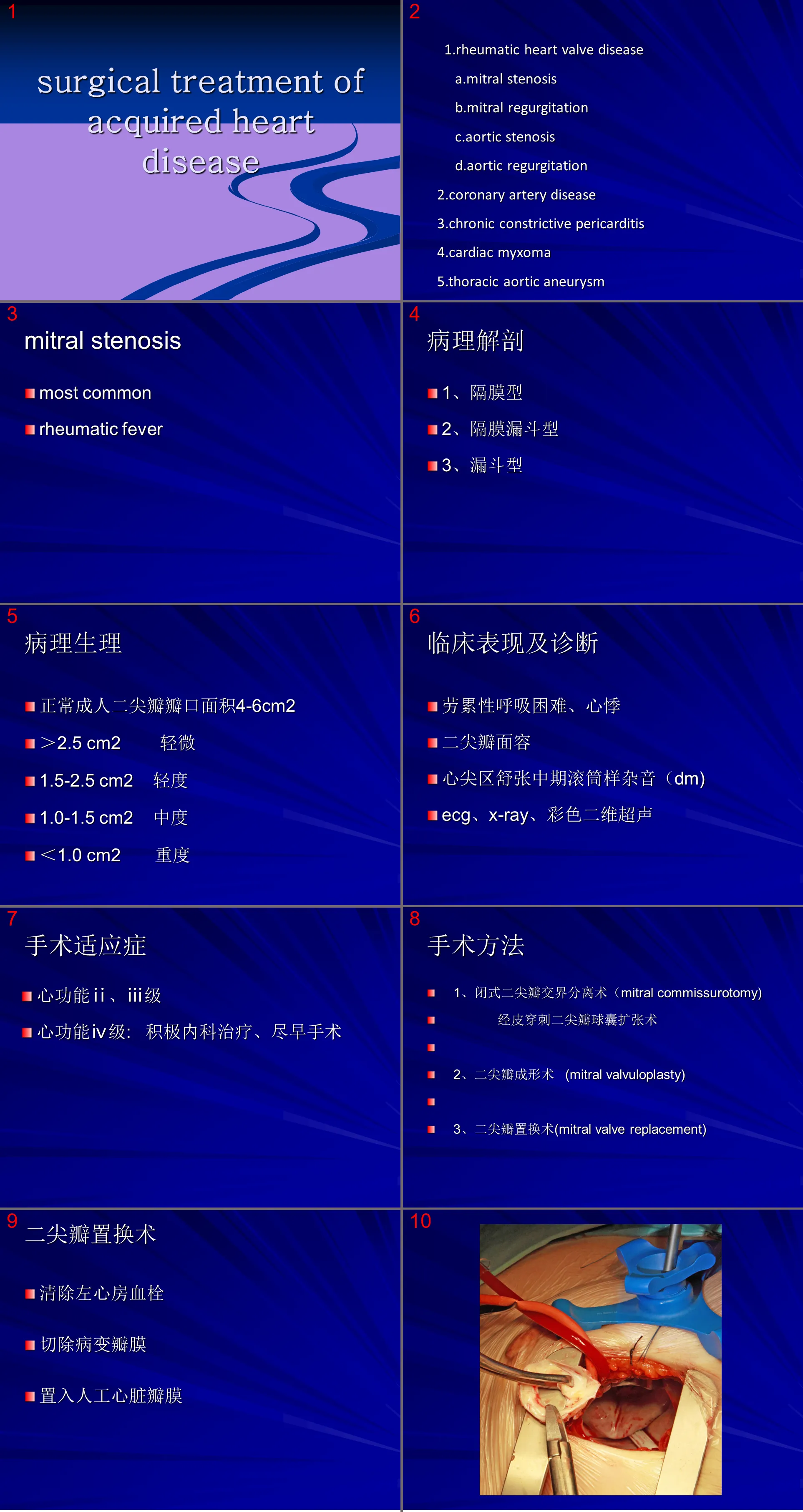 145 Cardiovascular Medicine-Posterior Heart Disease