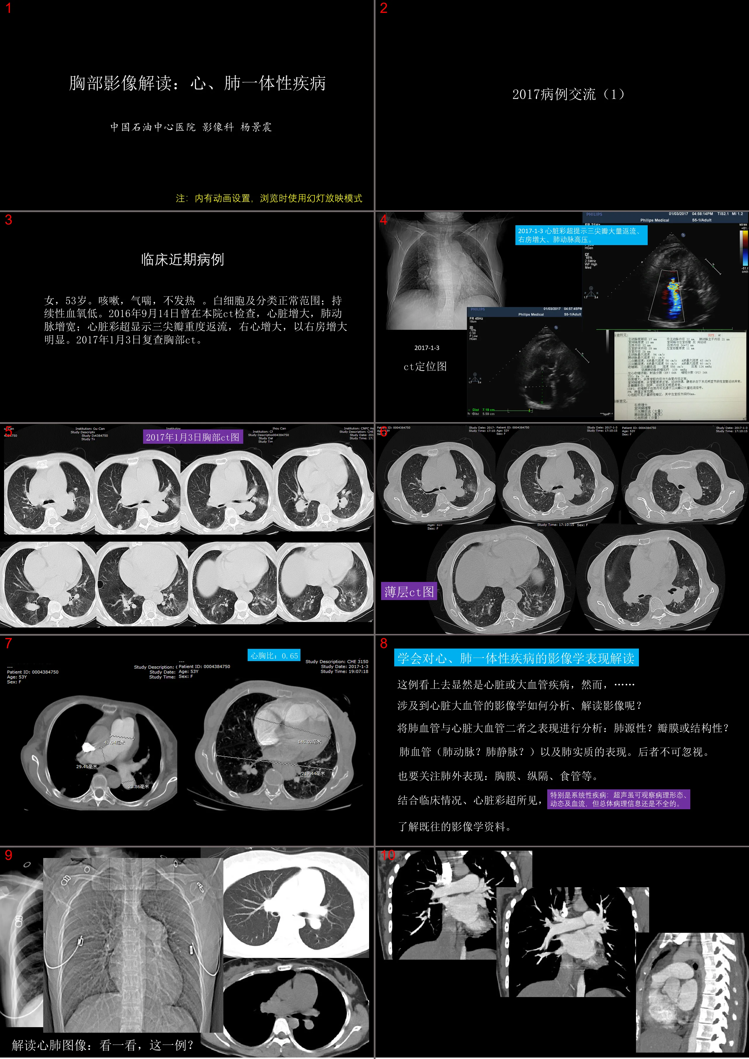 Interpretation of chest images: cardiopulmonary integration disease