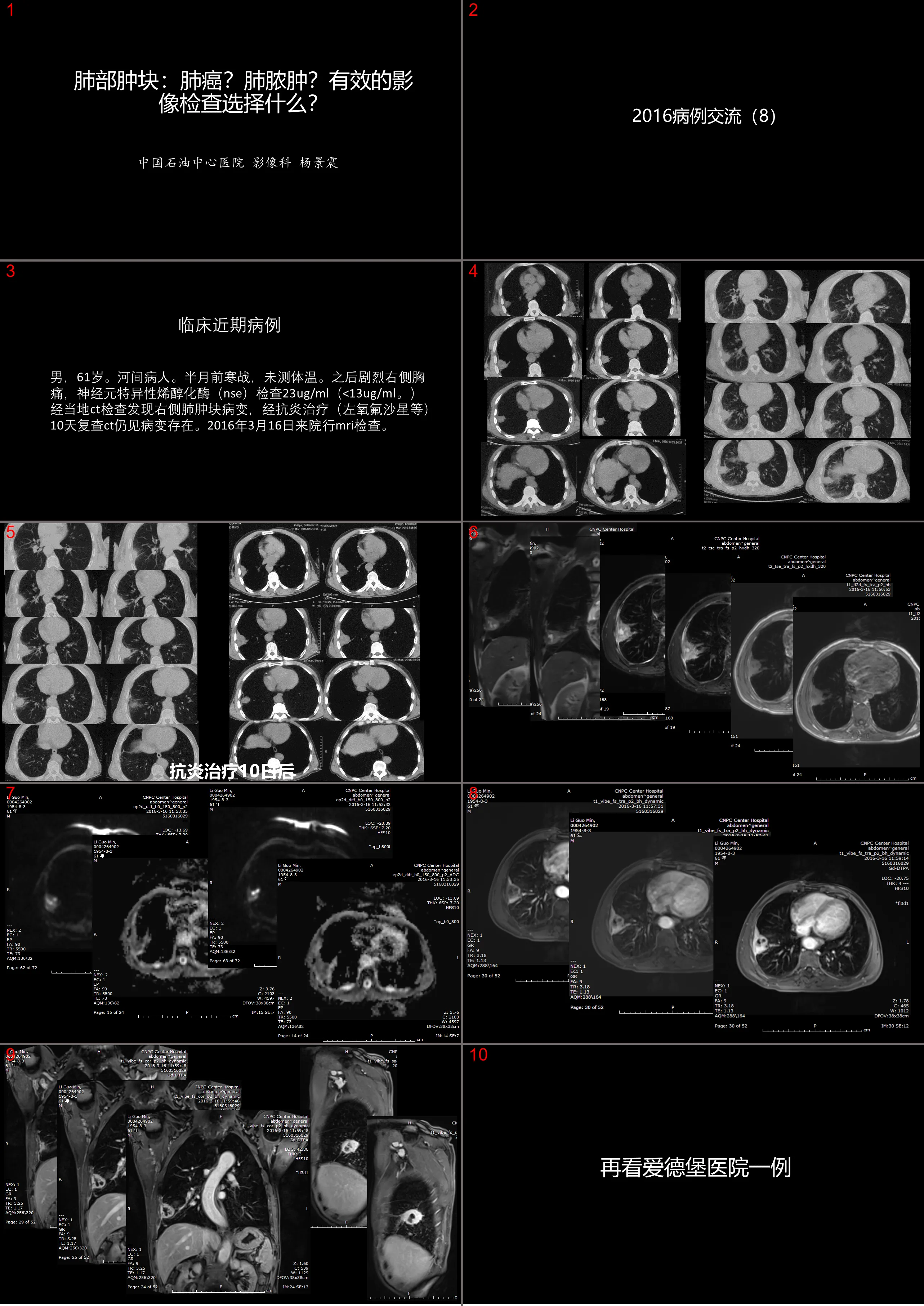 Effective imaging options for lung masses