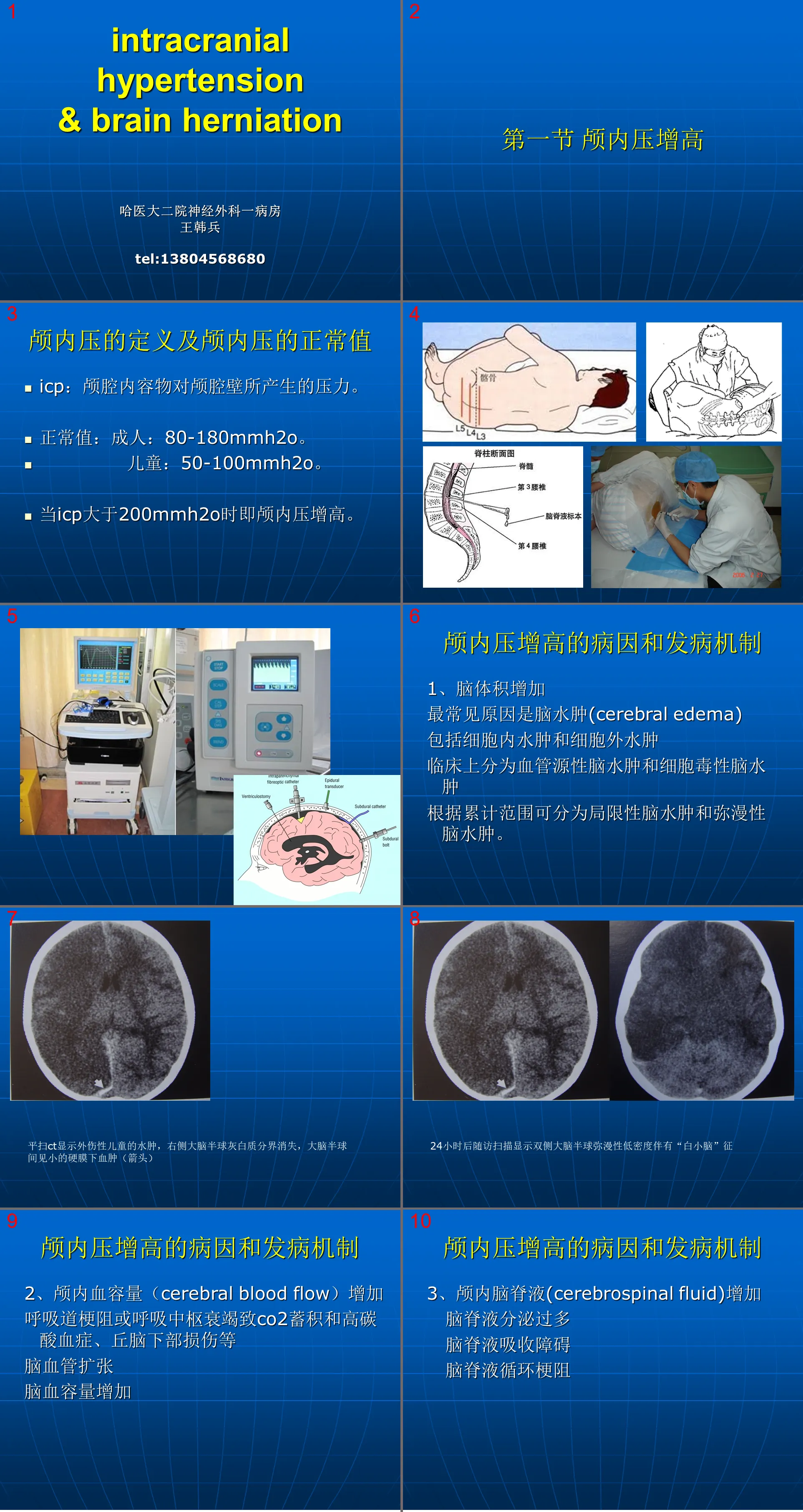 94 Neurology-Increased intracranial pressure and brain herniation