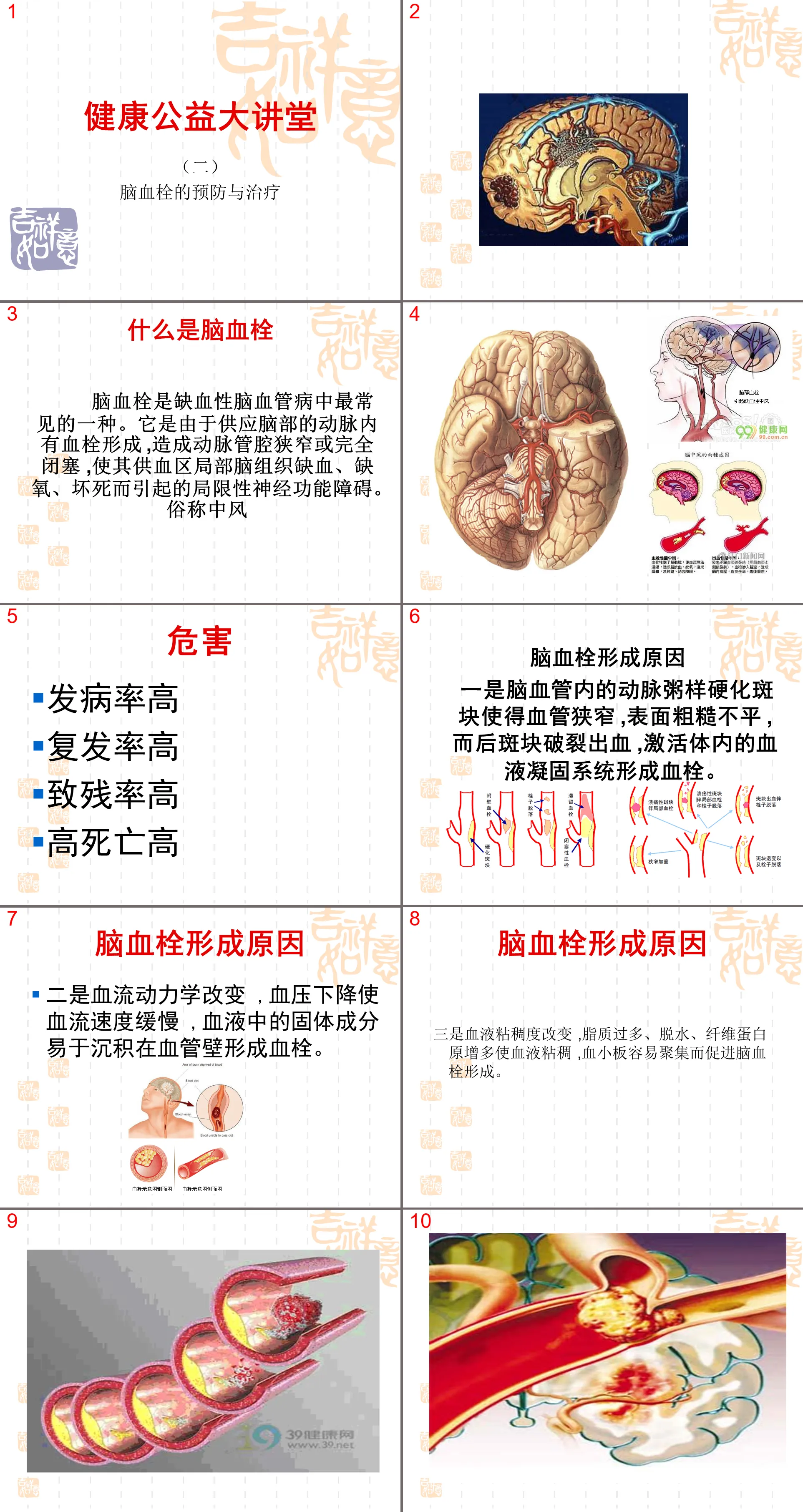 99NeurologyCerebral Thrombosis