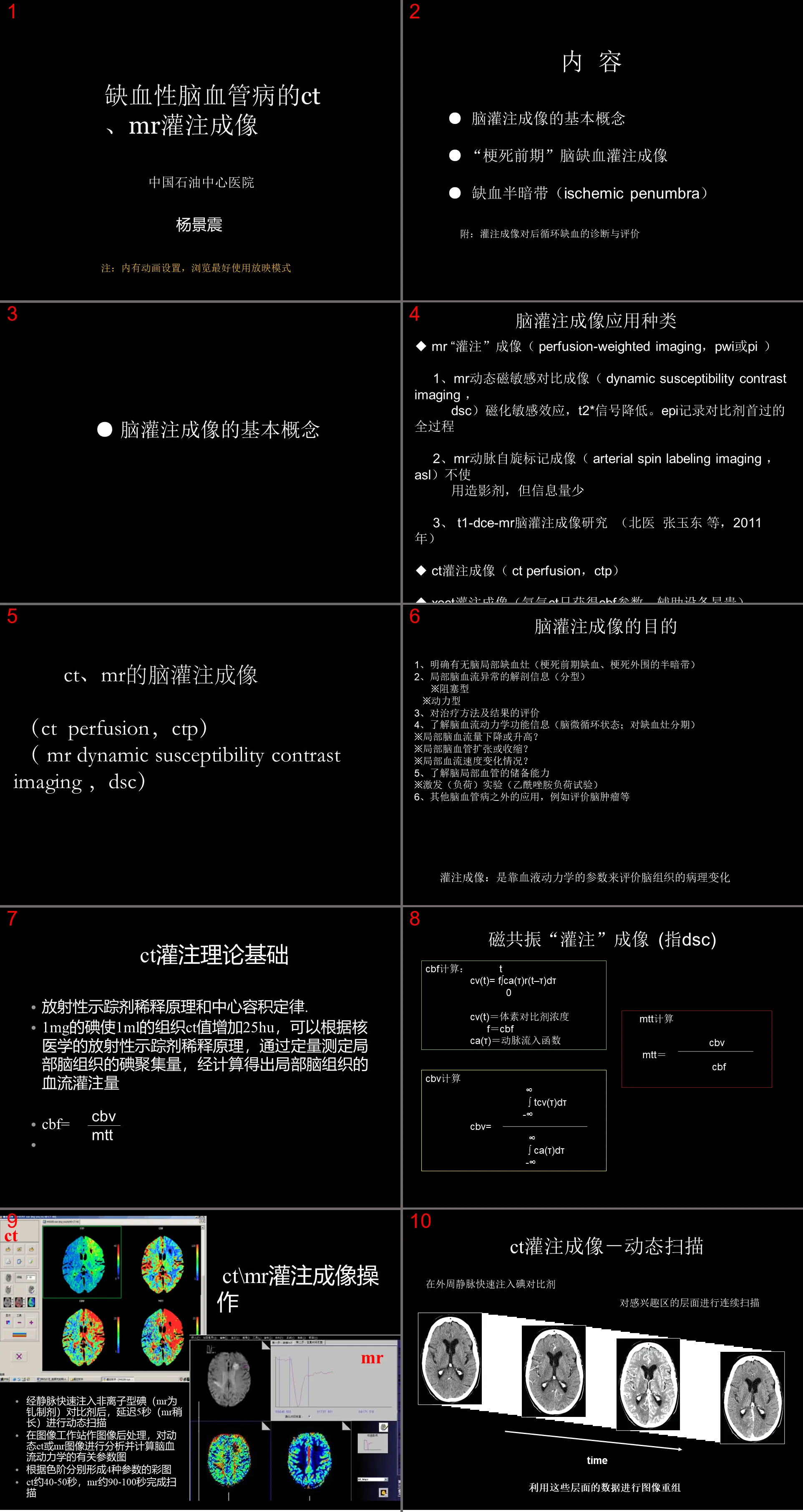 腦缺血的CT、MR灌注造影