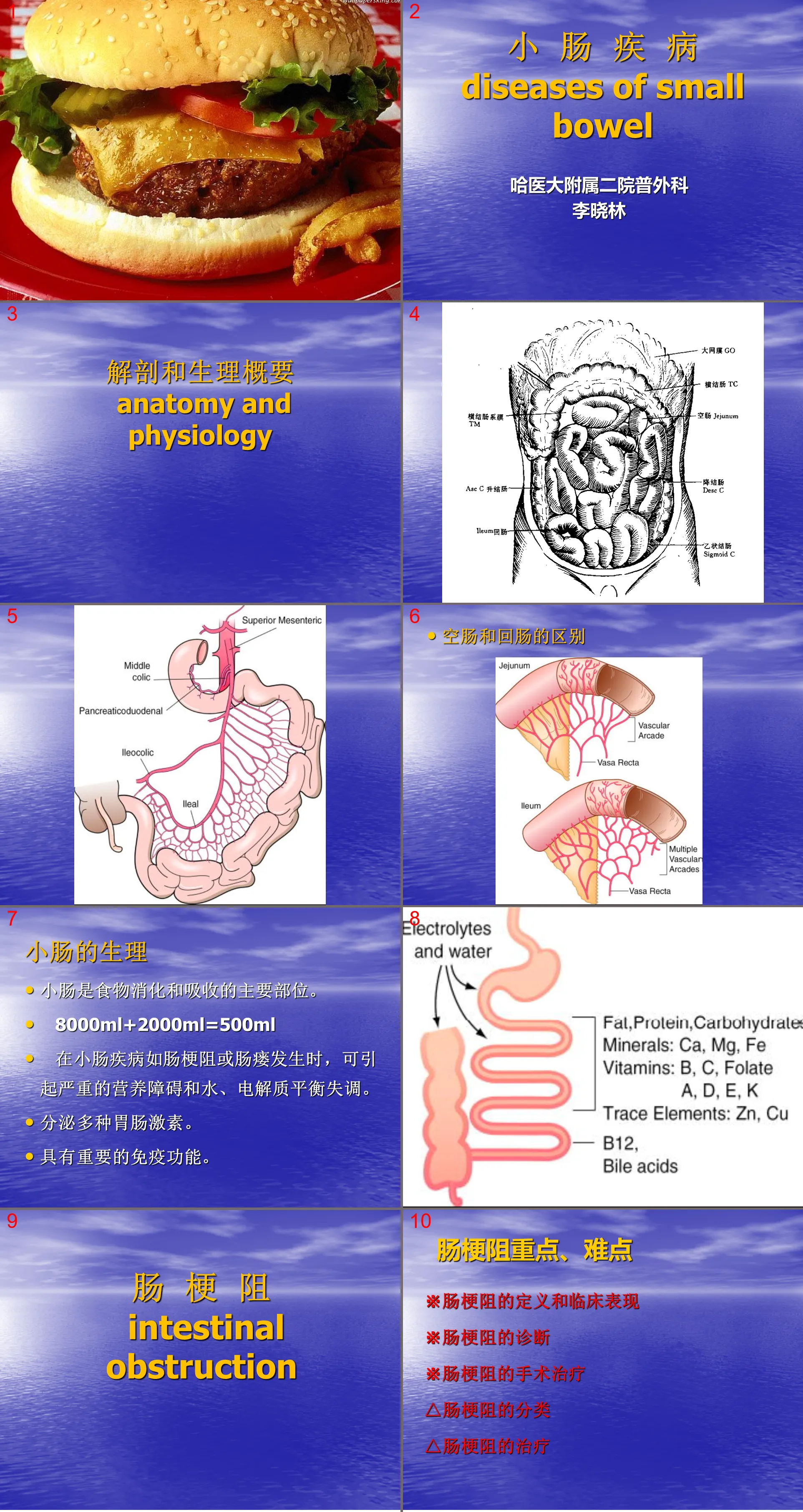 138 Small intestine + upper gastrointestinal bleeding