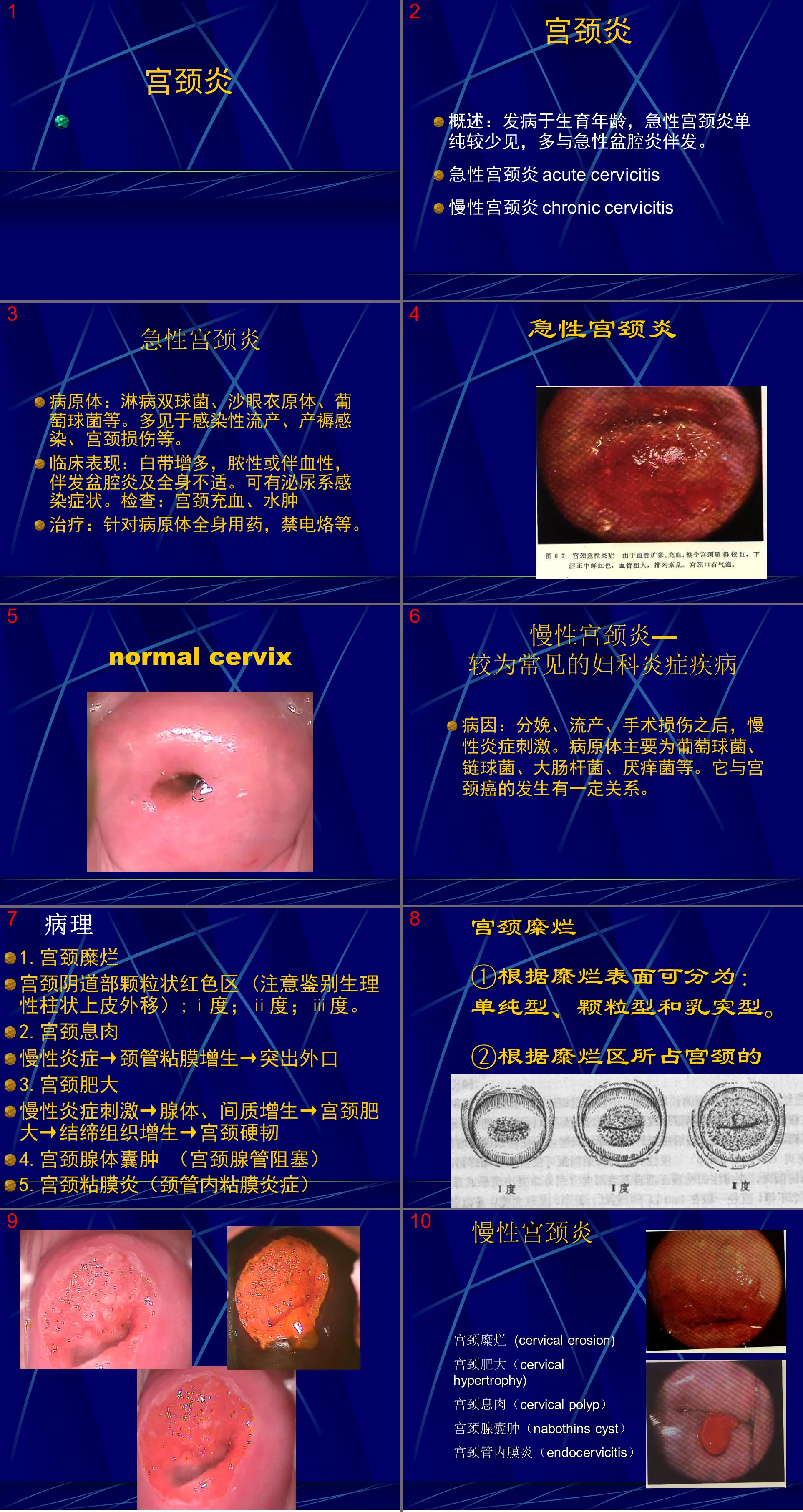 12婦產科-骨盆腔炎子宮頸炎