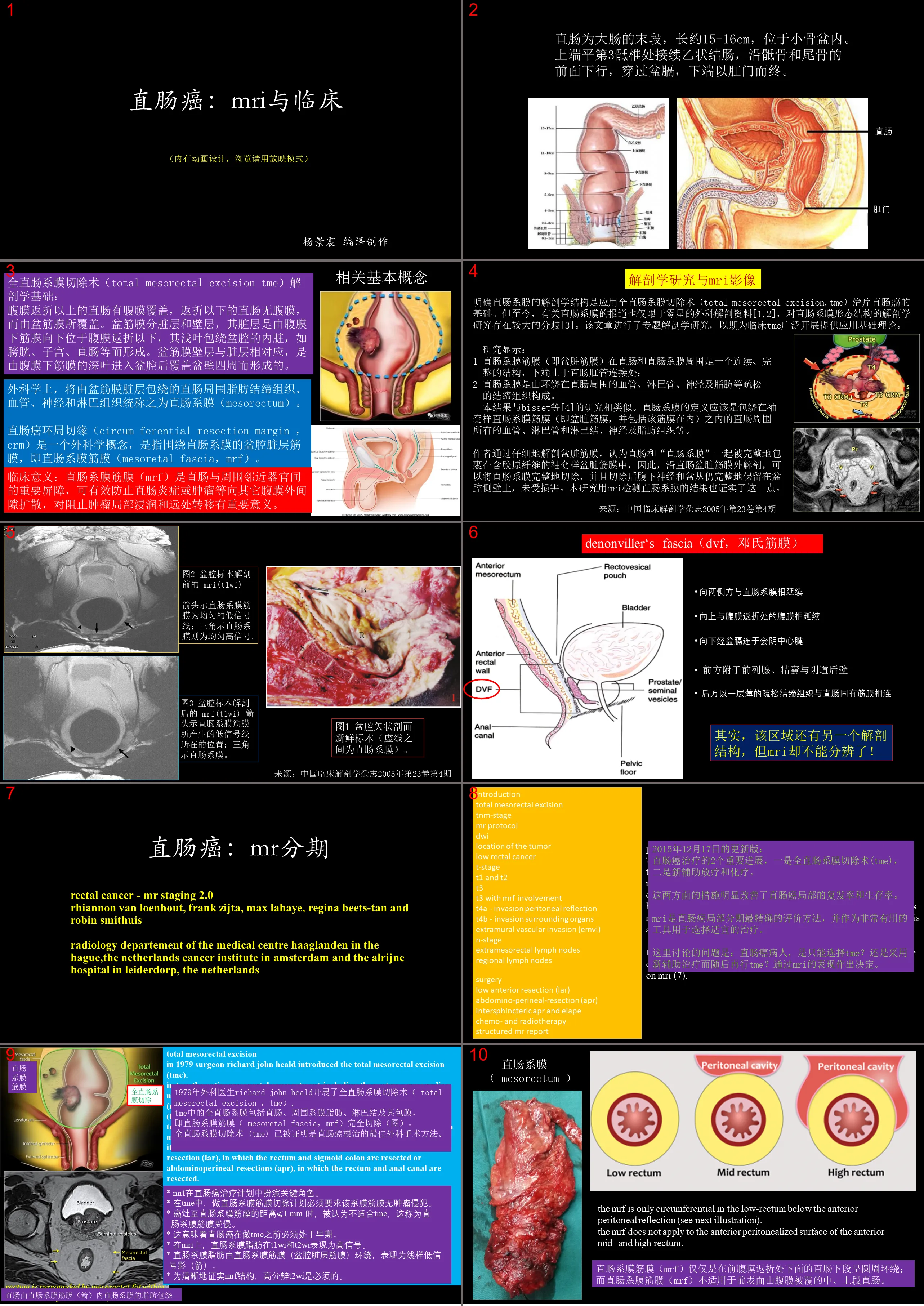 Rectal cancer: MRI and clinical diagnosis