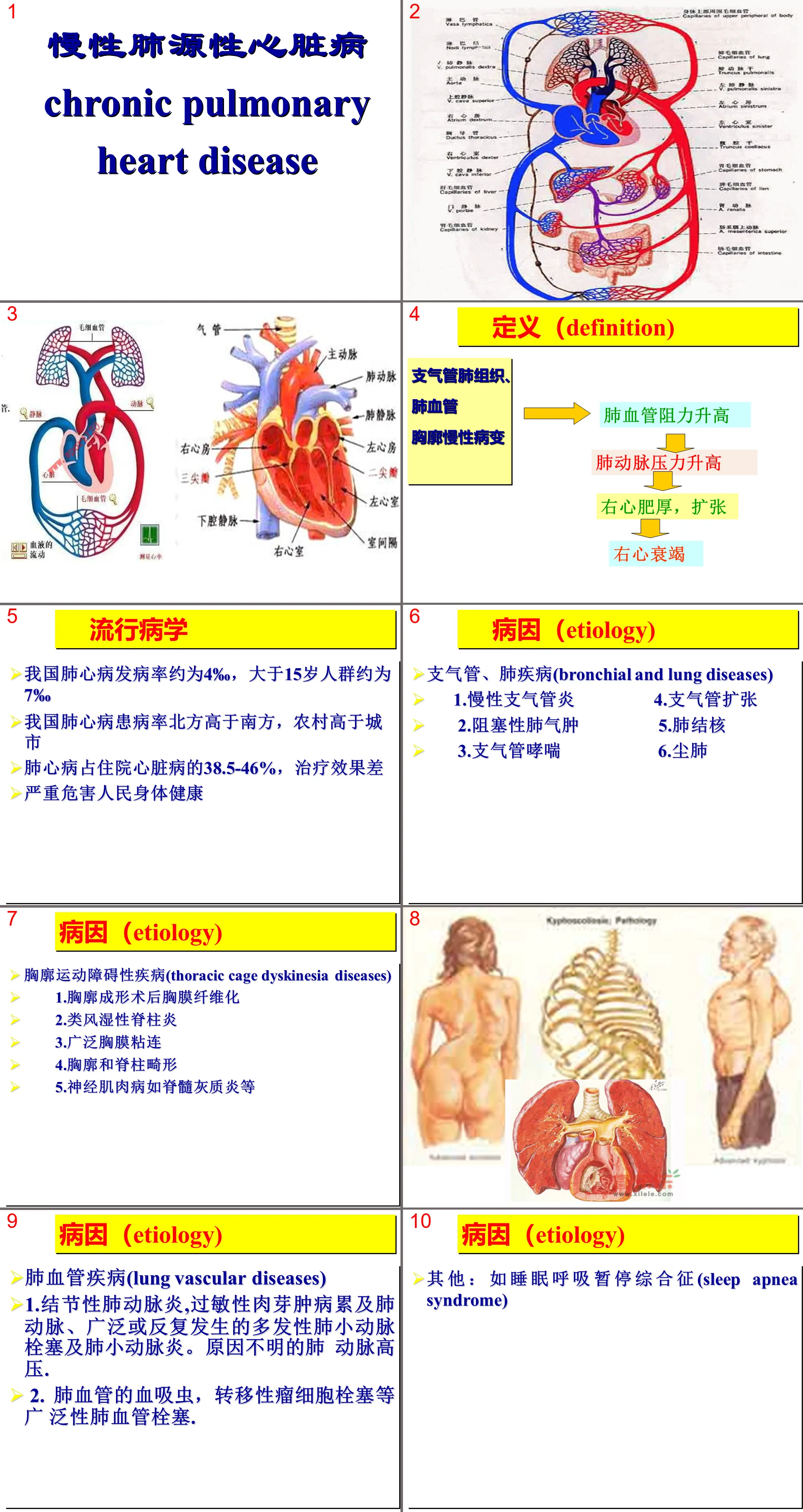 37呼吸内科-肺源性心脏病