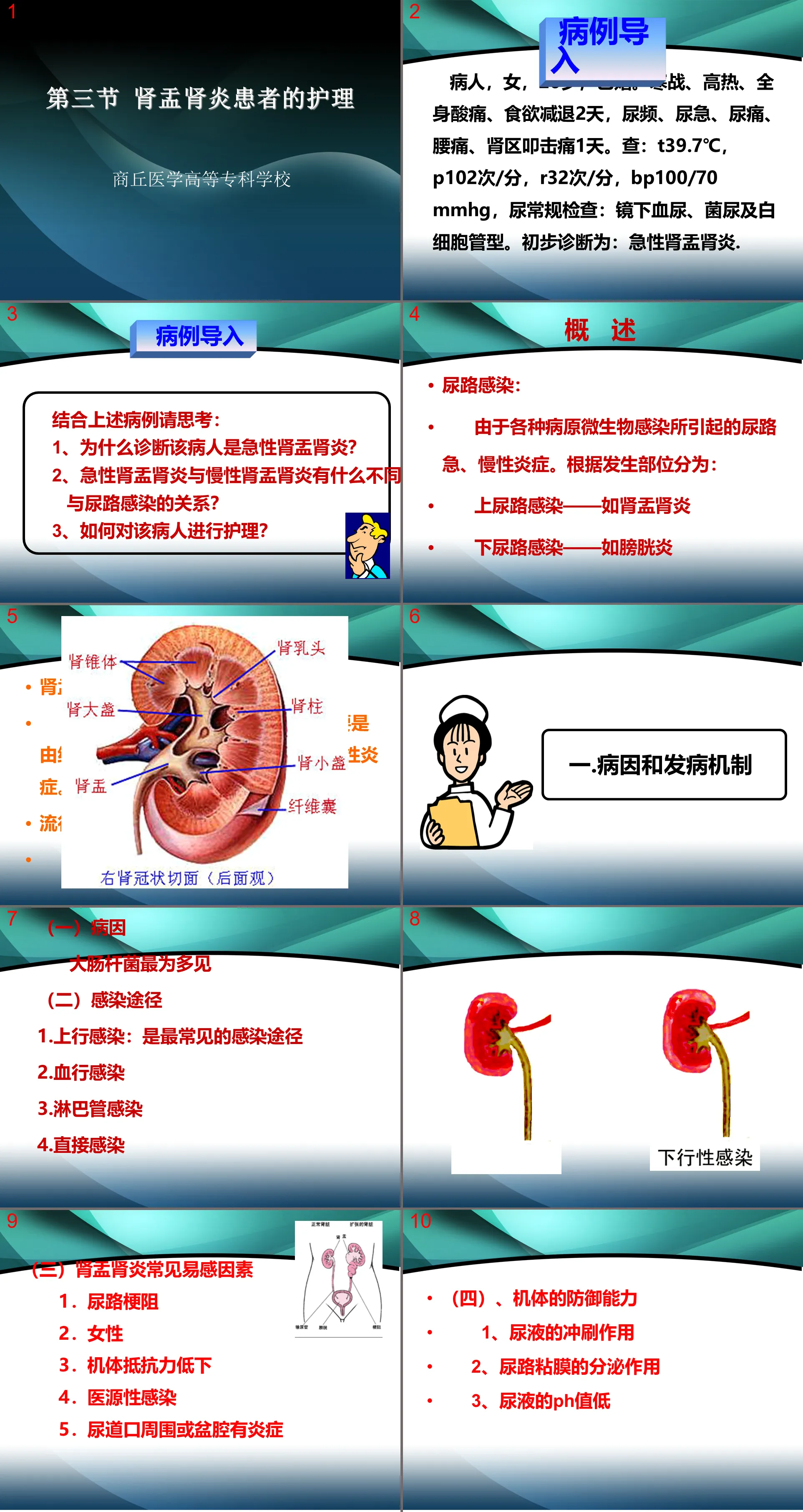 106腎內科-腎盂腎炎2