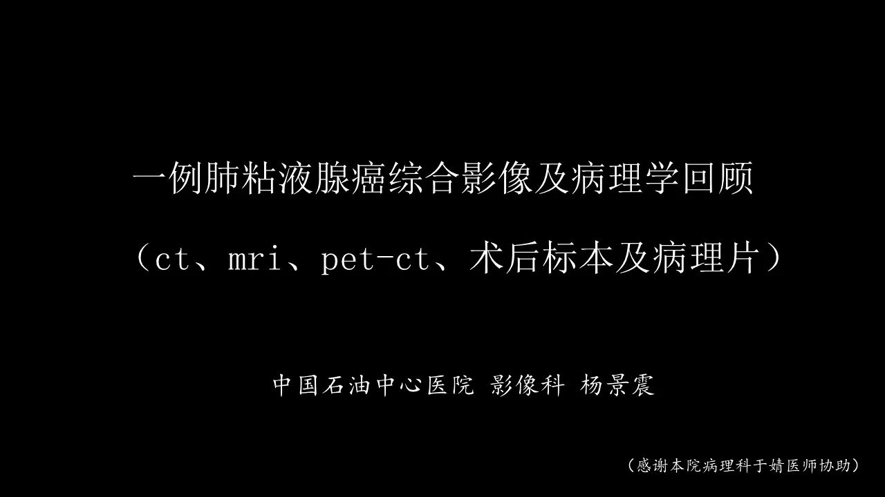 一例肺黏液腺癌綜合影像及病理學回顧