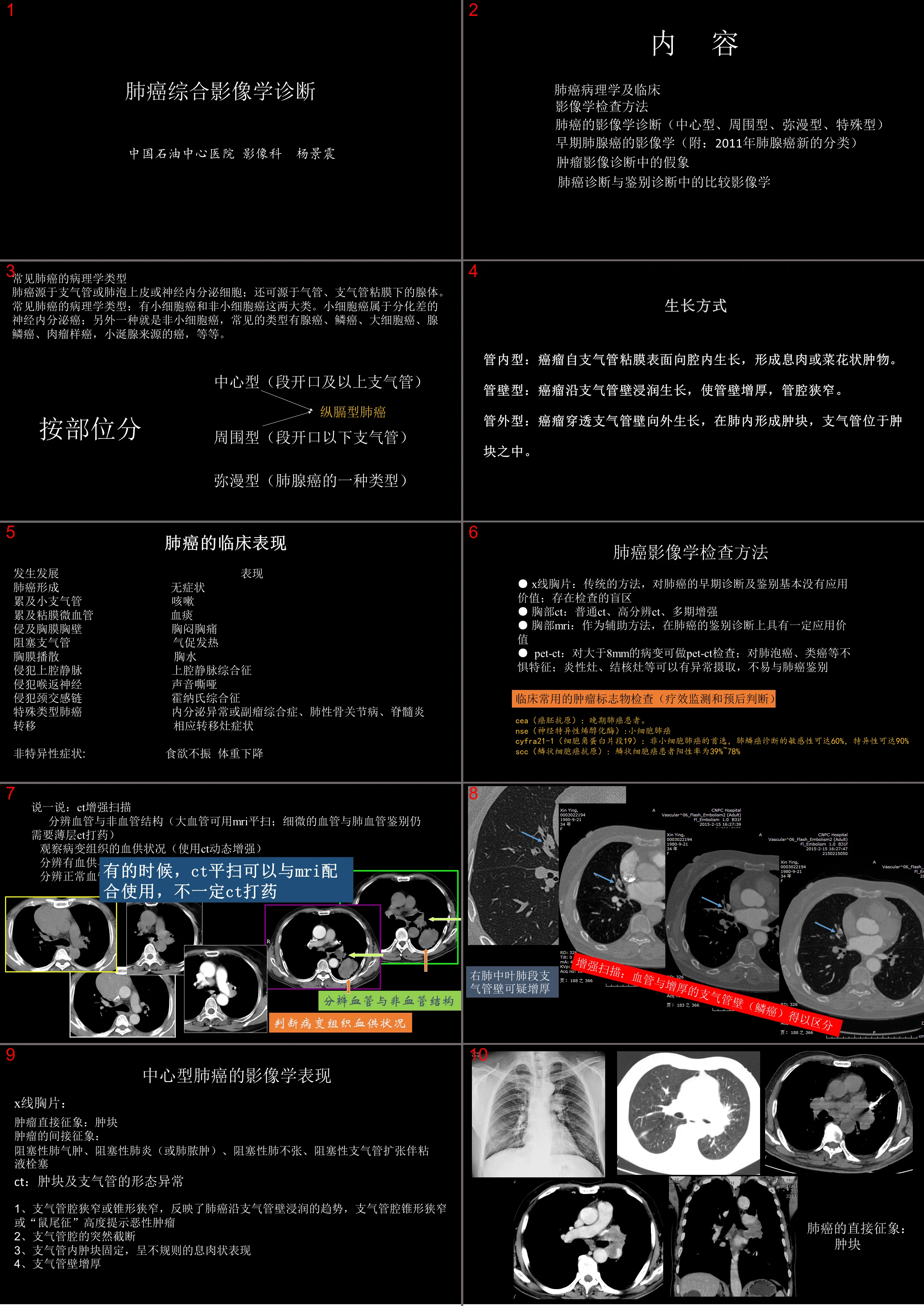 肺癌的综合影像学诊断